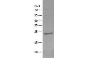 Western Blotting (WB) image for Toll-Like Receptor Adaptor Molecule 2 (TICAM2) (AA 1-235) protein (His-IF2DI Tag) (ABIN7125416)