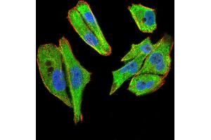Immunofluorescence analysis of Hela cells using TBCC mouse mAb (green).