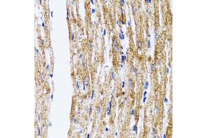 Immunohistochemistry of paraffin-embedded mouse heart using MAP1LC3B antibody. (LC3B anticorps)