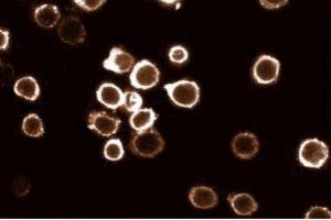 Immunofluorescent staining of HL60 cells with anti-HS1 antibody. (HCLS1 anticorps  (AA 17-190))