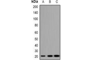 Western blot analysis of TRAPPC5 expression in A549 (A), NIH3T3 (B), H9C2 (C) whole cell lysates. (TRAPPC5 anticorps)
