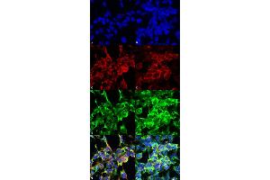 Immunocytochemistry/Immunofluorescence analysis using Mouse Anti-Methylglyoxal Monoclonal Antibody, Clone 9E7 . (Methylglyoxal (MG) anticorps (PE))