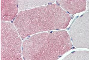 Anti-TXLNB antibody  ABIN1049448 IHC staining of human skeletal muscle.