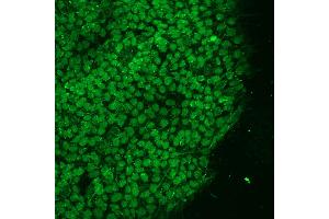 anti-POU Class 5 Homeobox 1 (POU5F1) antibody