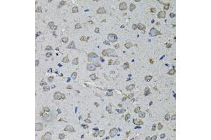 Immunohistochemistry of paraffin-embedded mouse brain using IL1A antibody (ABIN6291332) at dilution of 1:100 (40x lens). (IL1A anticorps)