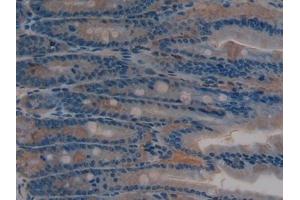 Detection of SIRT2 in Rat Intestine Tissue using Polyclonal Antibody to Sirtuin 2 (SIRT2)