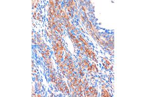 Immunohistochemistry of paraffin-embedded Rat ovary using ZPBP Rabbit pAb (ABIN7271569) at dilution of 1:100 (40x lens).
