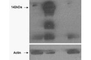 Western Blotting (WB) image for anti-Tankyrase, TRF1-Interacting Ankyrin-Related ADP-Ribose Polymerase (TNKS) (N-Term) antibody (ABIN2464160) (TNKS anticorps  (N-Term))