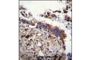 TTBK2 Antibody (N-term) (ABIN656096 and ABIN2845439) immunohistochemistry analysis in formalin fixed and paraffin embedded human lung tissue followed by peroxidase conjugation of the secondary antibody and DAB staining. (TTBK2 anticorps  (N-Term))