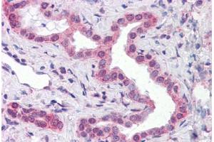 Human Liver, bile ducts: Formalin-Fixed, Paraffin-Embedded (FFPE)