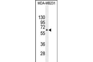 HNF1B Antibody (C-term) (ABIN655066 and ABIN2844696) western blot analysis in MDA-M cell line lysates (35 μg/lane). (HNF1B anticorps  (C-Term))