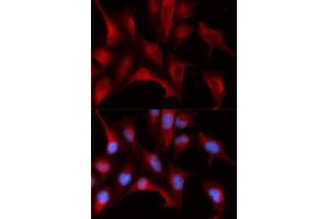 Immunofluorescence analysis of U2OS cells using PSMB4 antibody. (PSMB4 anticorps  (AA 1-264))