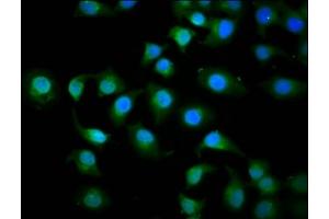 Immunofluorescence staining of A549 cells with ABIN7157651 at 1:200, counter-stained with DAPI. (KIF3C anticorps  (AA 158-267))