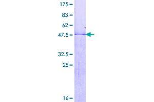 Image no. 1 for Homeobox B7 (HOXB7) (AA 1-217) protein (GST tag) (ABIN1306962)