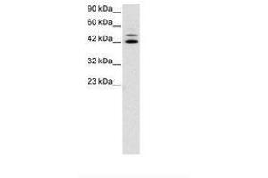 Image no. 3 for anti-Interferon Regulatory Factor 8 (IRF8) (AA 35-84) antibody (ABIN6735806)