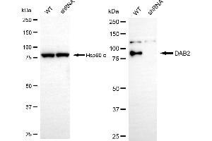 Western blotting analysis using DAB2 antibody (ABIN7798352). (Recombinant DAB2 anticorps)