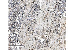 IHC analysis of SEC14L3/TAP2 using anti-SEC14L3/TAP2 antibody (ABIN7601623). (SEC14L3 anticorps  (AA 4-400))