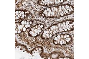 Immunohistochemical staining of human colon with TATDN3 polyclonal antibody  shows strong nuclear, cytoplasmic and membranous positivity in glandular cells.
