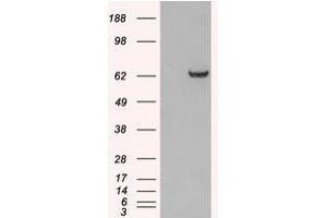 Image no. 1 for anti-Growth Factor Receptor-Bound Protein 7 (GRB7) (N-Term) antibody (ABIN374205) (GRB7 anticorps  (N-Term))