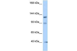 WB Suggested Anti-Ofd1 Antibody Titration: 1. (OFD1 anticorps  (N-Term))