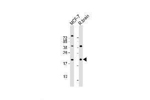Western Blot at 1:2000 dilution Lane 1: MCF-7 whole cell lysate Lane 2: rat brain lysate Lysates/proteins at 20 ug per lane. (RAC1 anticorps  (AA 49-78))