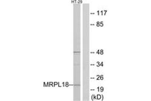 Western blot analysis of extracts from HT-29 cells, using MRPL18 Antibody. (MRPL18 anticorps  (AA 1-50))