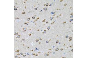 Immunohistochemistry of paraffin-embedded mouse brain using NAPA antibody. (NAPA anticorps)