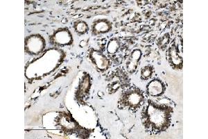 IHC analysis of VPRBP/DCAF1 using anti-VPRBP/DCAF1 antibody (ABIN7599063). (DDB1 and CUL4-Associated Factor 1 (DCAF1) (AA 1-195) anticorps)