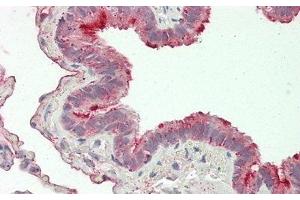 Detection of FOLR1 in Human Lung Tissue using Polyclonal Antibody to Folate Receptor 1, Adult (FOLR1)