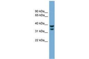 Image no. 1 for anti-Interferon Regulatory Factor 1 (IRF1) (AA 251-300) antibody (ABIN6744534) (IRF1 anticorps  (AA 251-300))