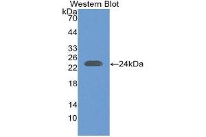 Western Blotting (WB) image for anti-Interleukin 29 (IL29) (AA 20-200) antibody (ABIN1868653) (IL29 anticorps  (AA 20-200))