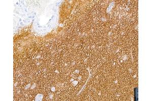 Immunohistochemistry (IHC) image for anti-Neural Cell Adhesion Molecule 1 (NCAM1) (AA 20-318) antibody (ABIN7449431)