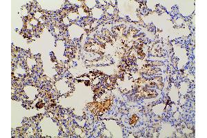 ABIN6267452 at 1/100 staining rat lung tissue sections by IHC-P.