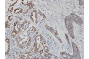 IHC-P Image Immunohistochemical analysis of paraffin-embedded H661 xenograft, using KRT2, antibody at 1:100 dilution.