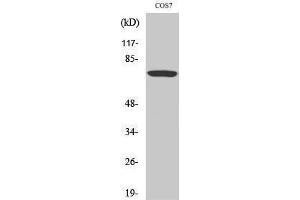Western Blotting (WB) image for anti-V-Raf-1 Murine Leukemia Viral Oncogene Homolog 1 (RAF1) (pSer259) antibody (ABIN3182138) (RAF1 anticorps  (pSer259))
