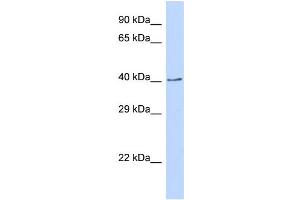 Host:  Rabbit  Target Name:  CDS2  Sample Type:  293T Whole cell lysates  Antibody Dilution:  1. (CDS2 anticorps  (C-Term))
