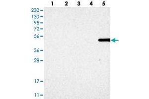 Western blot analysis of Lane 1: RT-4, Lane 2: U-251 MG, Lane 3: Human Plasma, Lane 4: Liver, Lane 5: Tonsil with MFSD6L polyclonal antibody . (MFSD6L anticorps)