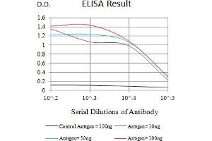 Black line: Control Antigen (100 ng),Purple line: Antigen (10 ng), Blue line: Antigen (50 ng), Red line:Antigen (100 ng)