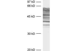 Western Blotting (WB) image for anti-tau Protein (AA 3-214) antibody (ABIN1742569)