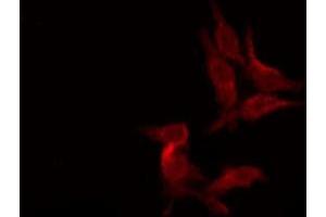 ABIN6276106 staining Hela by IF/ICC.