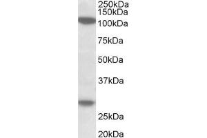 ABIN5539532 (1µg/ml) staining of MOLT4 lysate (35µg protein in RIPA buffer). (Ubinuclein 1 anticorps  (Internal Region))