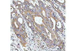 anti-Glutamate-Cysteine Ligase, Catalytic Subunit (GCLC) (AA 437-637) antibody
