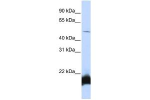 WB Suggested Anti-ONECUT1 Antibody Titration:  0. (ONECUT1 anticorps  (N-Term))