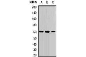 Western blot analysis of PARP3 expression in HEK293T (A), Raw264. (PARP3 anticorps  (N-Term))