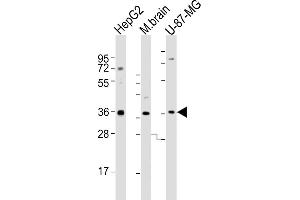 All lanes : Anti-CRYZ Antibody (C-term) at 1:2000 dilution Lane 1: HepG2 whole cell lysates Lane 2: mouse brain lysates Lane 3: U-87-MG whole cell lysates Lysates/proteins at 20 μg per lane. (CRYZ anticorps  (C-Term))