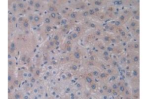 Detection of IL28A in Human Liver Tissue using Monoclonal Antibody to Interleukin 28A (IL28A)