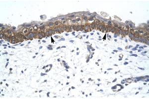 Human Skin (ZNF385A anticorps  (C-Term))
