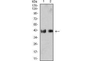Western blot analysis using CD132 mouse mAb against MOLT4 (1) and U937 (2) cell lysate. (IL2RG anticorps  (AA 23-262))