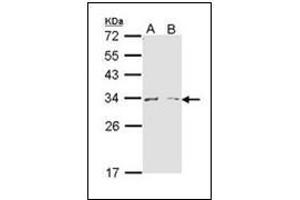 Western Blot analysis using ARG1 antibody at 1/1000 dilution. (Liver Arginase anticorps  (AA 1-145))