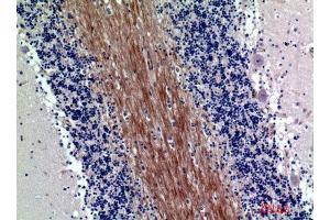 Immunohistochemistry (IHC) analysis of paraffin-embedded Human Brain, antibody was diluted at 1:200. (SIRP-Alpha1/beta1 (Internal Region) anticorps)